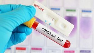 Covid-19 test kits PCR HPV